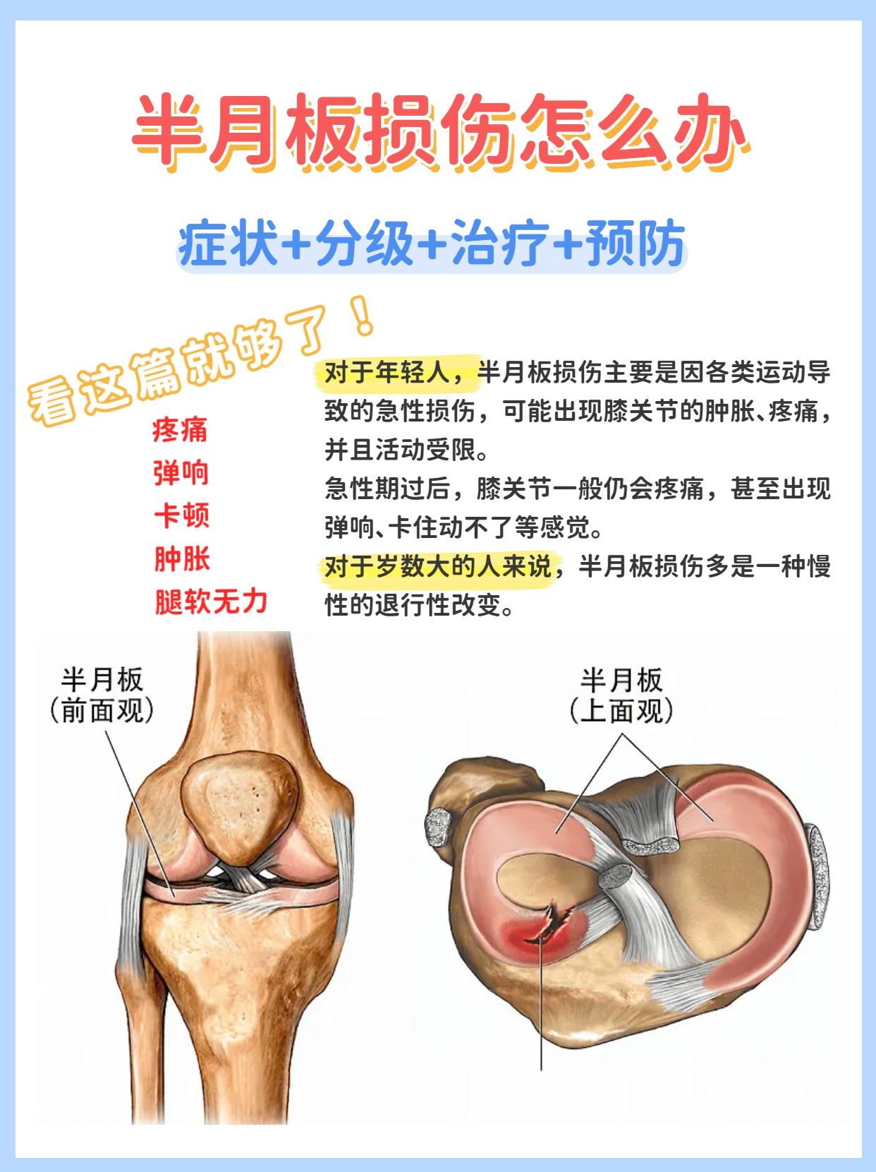 半月板磨损该怎么治疗(图1)